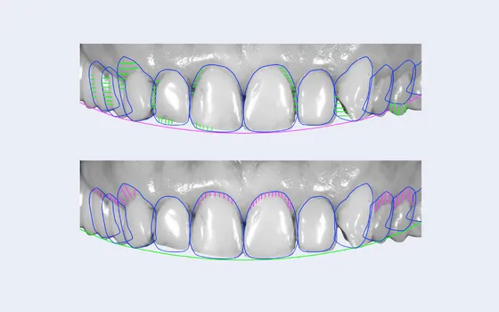 Digital cosmetic dentistry equipment